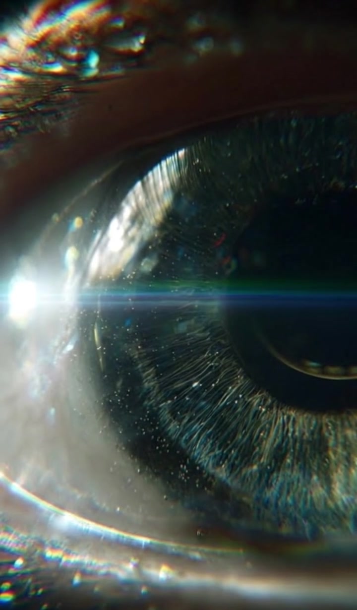 STAGES interstitial — Finegrain